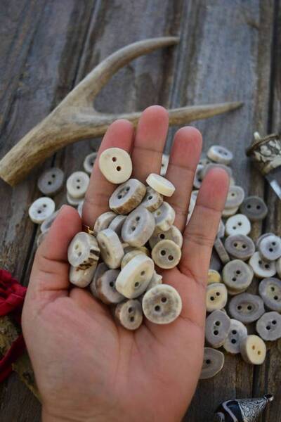 Fichier:Boutons-os.jpg